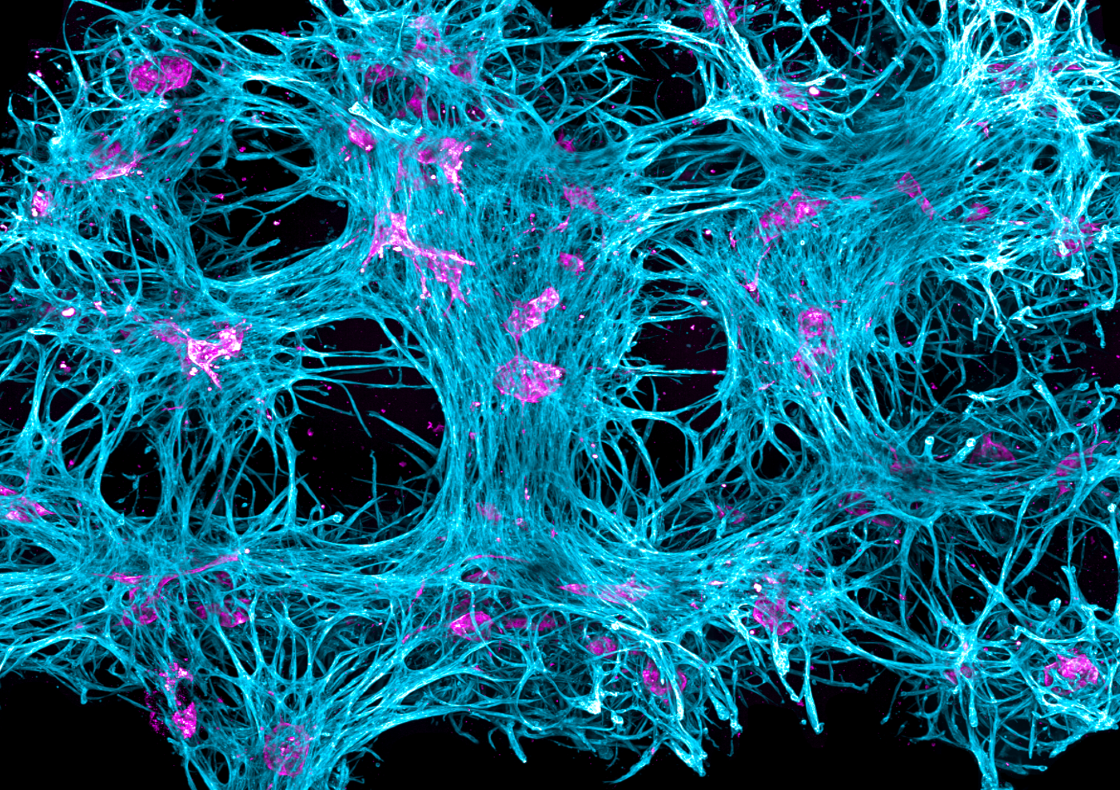 Cell Spheroid Growth