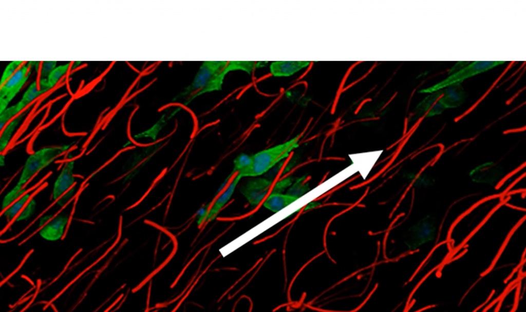 Anisogel: A New Hybrid Hydrogel for Tissue Regenerative Therapy